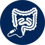 ENDOSCOPIA